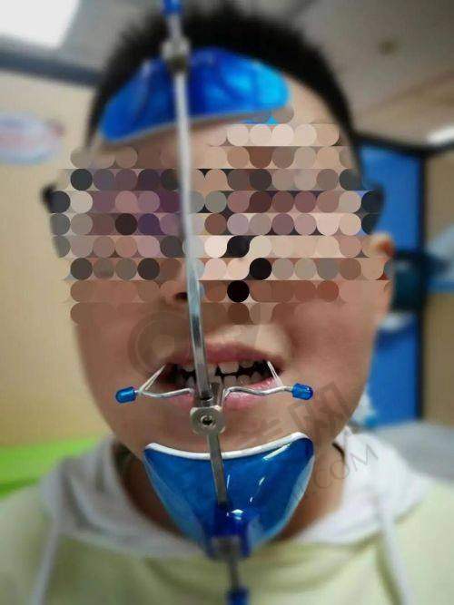 6000元起的价格包含哪些内容？