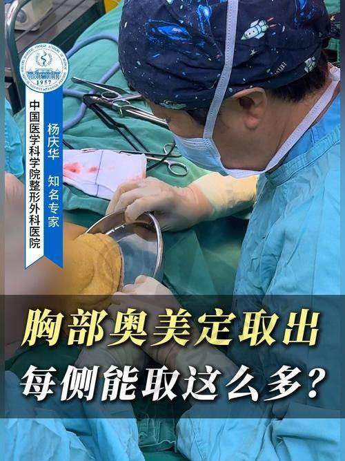 取奥美定后需要注意哪些事项？