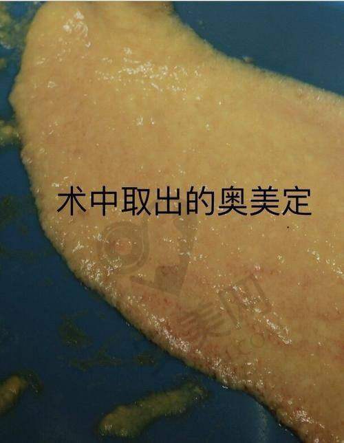 总结