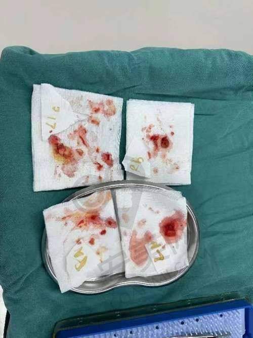 广州荔医：专精清奥修复中 心