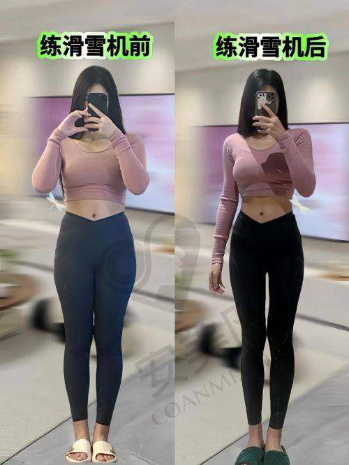 北京樱桃腿型矫正的诊疗成效如何？