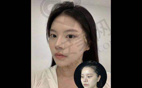 广州军美面部吸脂与其他医院相比有什么独特之处？