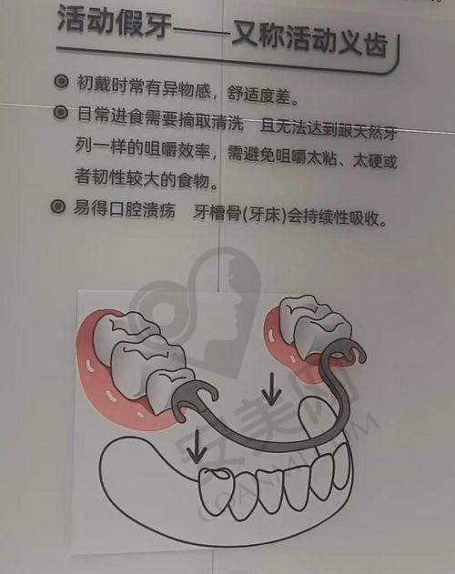 治疗前期：拔牙与等待