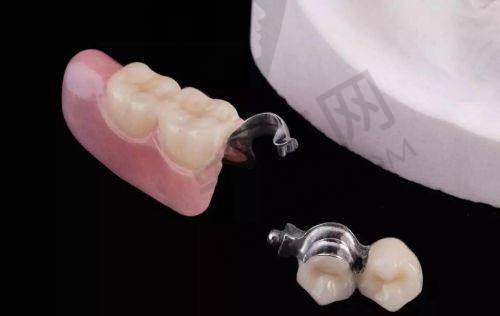总结：呼和浩特优洁口腔医院全口假牙就诊体验