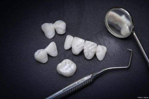 牙齿贴面美白技术是什么？