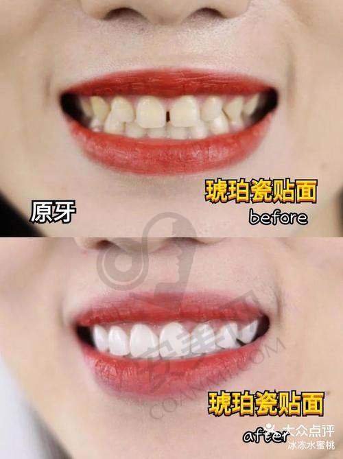 南通美特美口腔究竟怎么样？