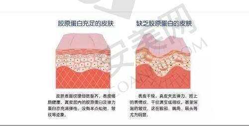 重庆星荣医院双下巴吸脂成功实例多吗？