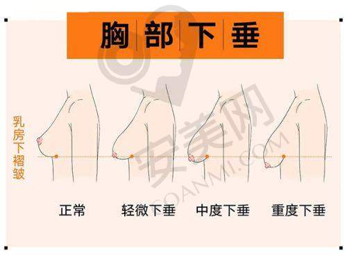 成都中医大银海医院馒化脸修复的成功实例