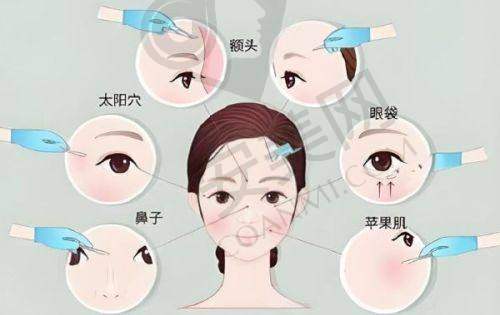 如何预约上海伯思立沈国雄院长的提眉术？