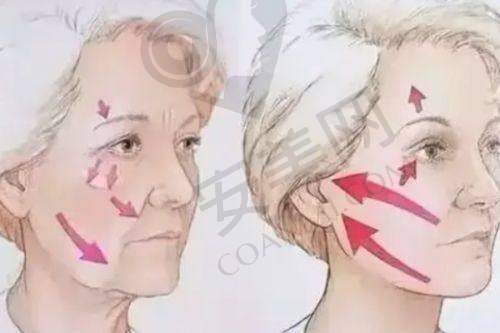 人中缩短手术在深圳福雅整形医院成效如何？患者评价高吗？