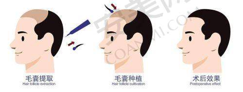 赣州韩美刘江医生整形技术怎么样？