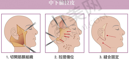 上海艺星有哪些有名的双眼皮医生？
