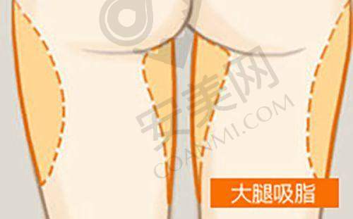 上海伯思立整形医院的价格是否合理？