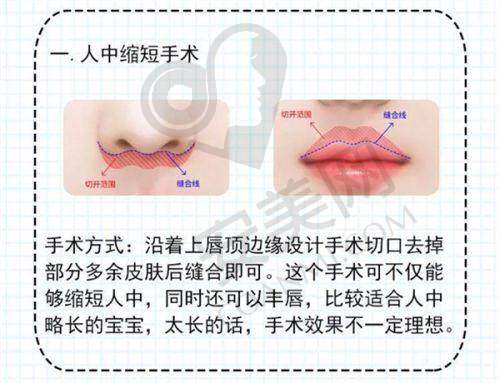 术后修复过程痛苦吗？
