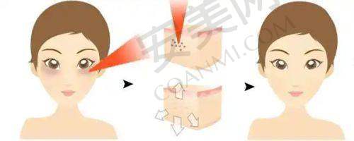 北京丽合医疗美容医院的口碑如何？