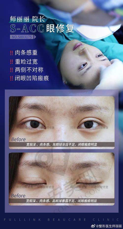 术后修复，会遇到哪些问题？