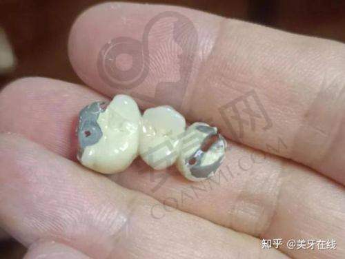 3980元起的价格包含哪些内容？