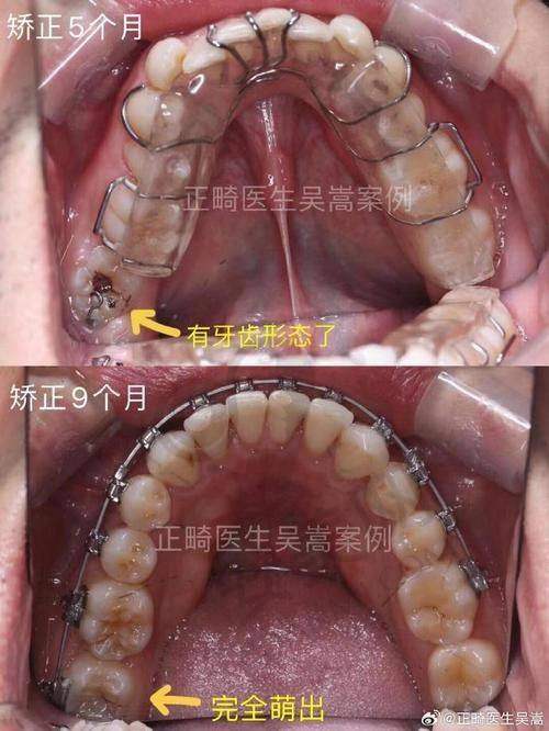西双版纳竹子口腔汪子媛医生预约挂号指南