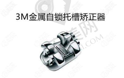 成都新桥口腔陶瓷自锁矫正有哪些优势？