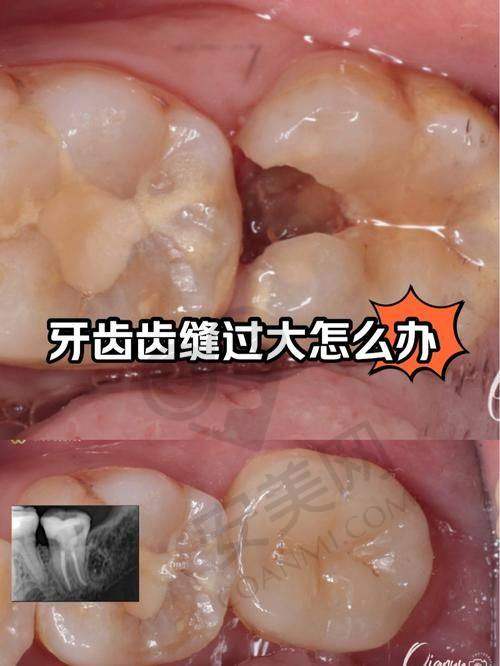 拉萨雅博仕口腔的口碑怎么样？