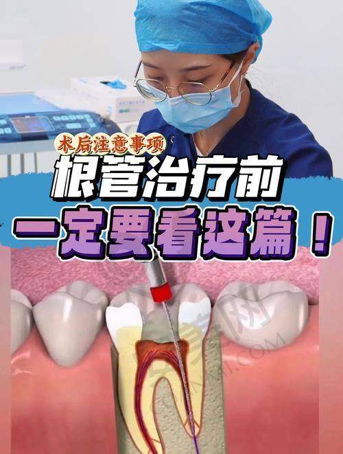 什么是牙齿根管治疗？