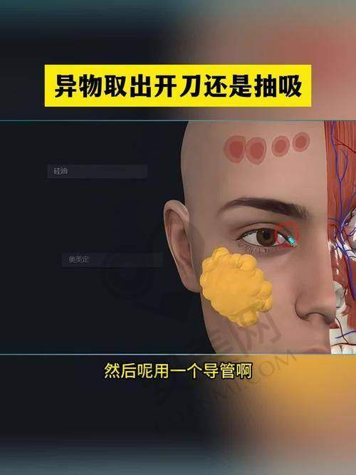 上海艺星减容馒化修复的价格是如何确定的？