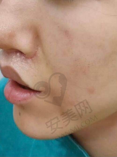 就诊前需要做哪些准备？