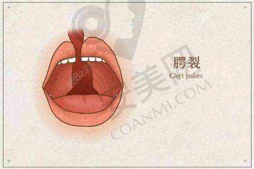 成都现代整形医院唇裂修复价格为何28000元起？