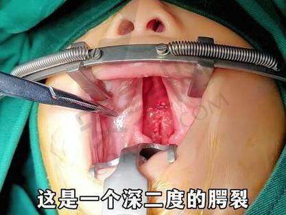 成都现代整形医院唇裂修复成功实例有哪些？