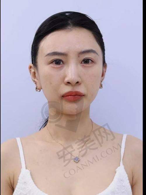 就诊过程是怎样的？