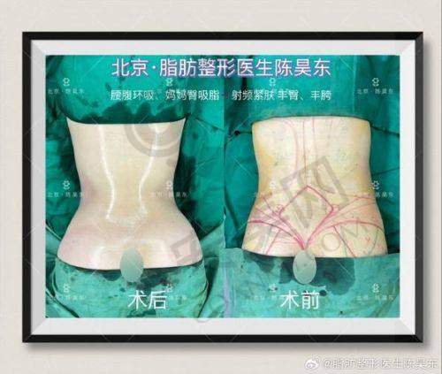 深圳今喜医疗美容门诊的服务和管理是否规范？