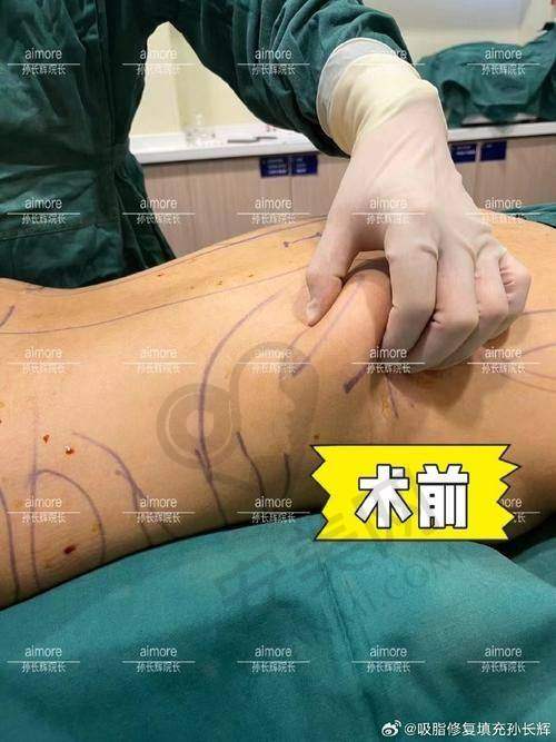 深圳今喜医疗美容门诊未来的发展前景如何？