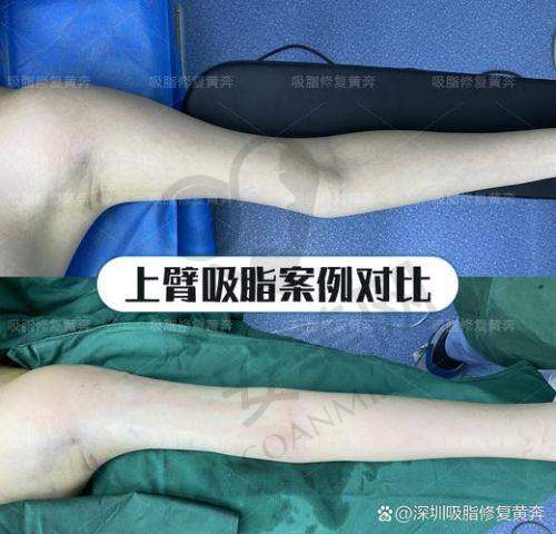 深圳今喜医疗美容门诊的投诉和纠纷情况如何？