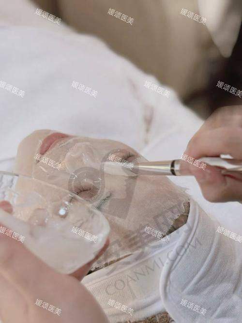 果酸换肤的治疗过程是怎样的体验？