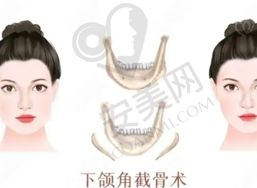 三线预约渠道：各有优势