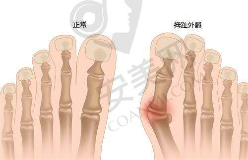 上海艺星整形医院服务质量对口碑有何影响？