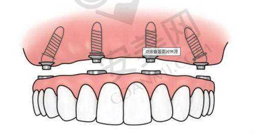 5、禹州微笑口腔刘岱豪医生患者评价：