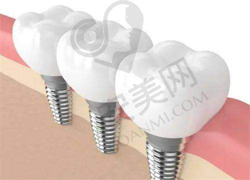 5、常熟安澜隆盈口腔刘娟医生患者评价