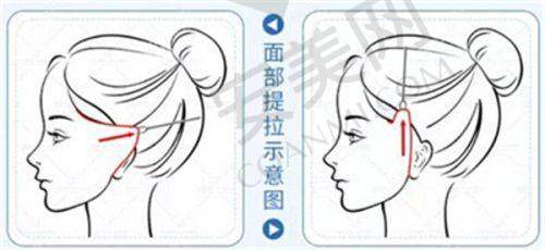 总结