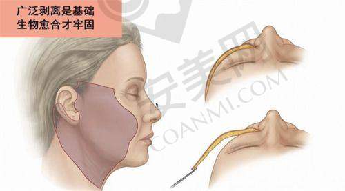 广州可玉医疗美容医院怎么样？