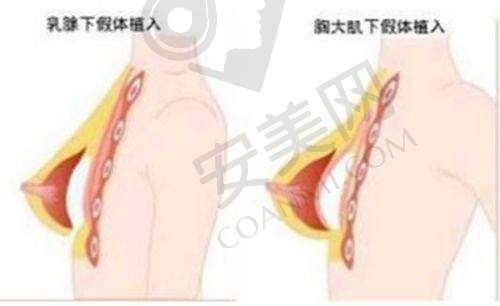 在成都中医 大银海医美整形医院修复“馒化脸”有什么感受？
