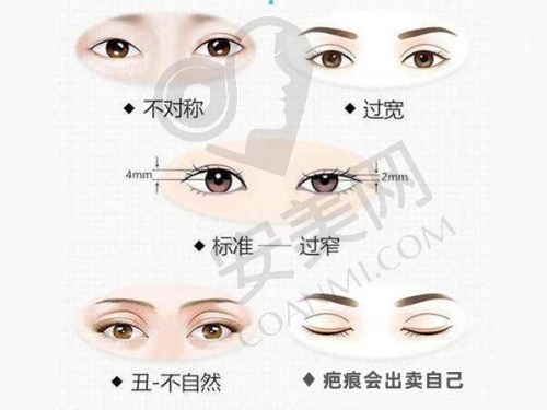 小切口面部拉皮适合哪些人？