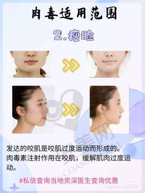 上海艺星整形医院医生团队水平怎样助力良好口碑？