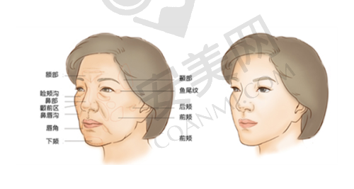 徐州华美双眼皮整形的安心性如何？