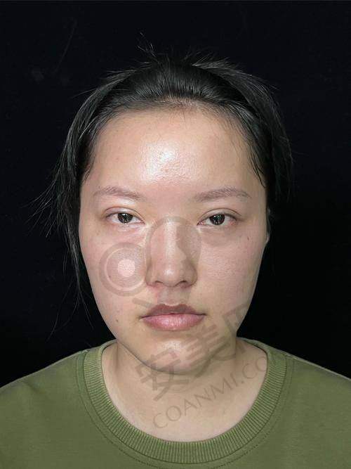 给我做手术的医生专精吗？
