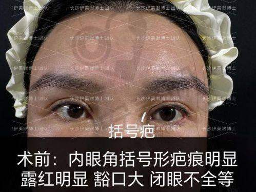 上海爱尚丽格眼修复与其他医院相比有哪些优势？