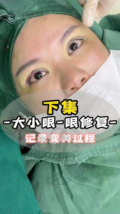 沈阳腾采双眼皮修复的初印象如何？