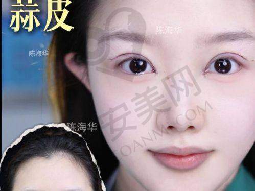 上海爱尚丽格眼修复的安心性有保护吗？