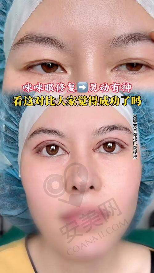 上海爱尚丽格眼修复的服务质量怎么样？