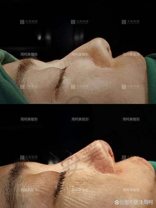 成都友谊整形医院隆鼻整形失败修复优势在哪里？